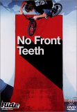 No Front Teeth